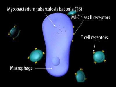 TB Treatment For The Elderly Likely Requires A Boost To Immune Response