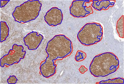 Advances in Scanning Technology