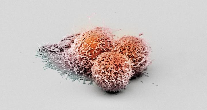 Cancer Cells