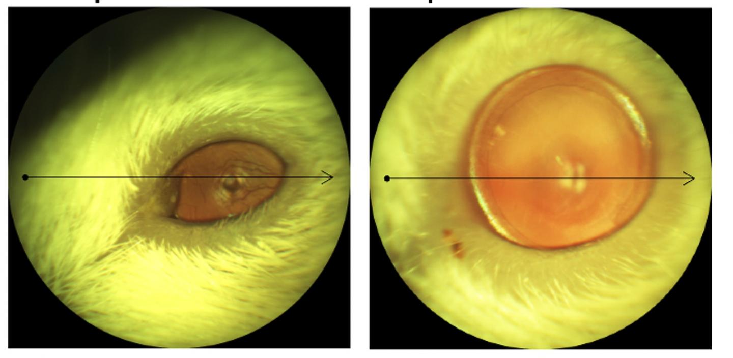 PAX6 cornea