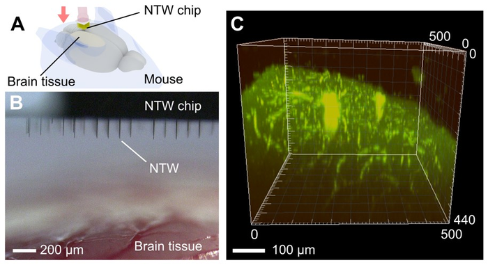 In vivo injection of Venus plasmid DNA into the brain tissue of a living mouse using a 200-µm-long NTW array (Fig2)