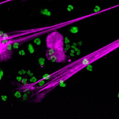 Neutrophil Extracellular Traps (NETs)