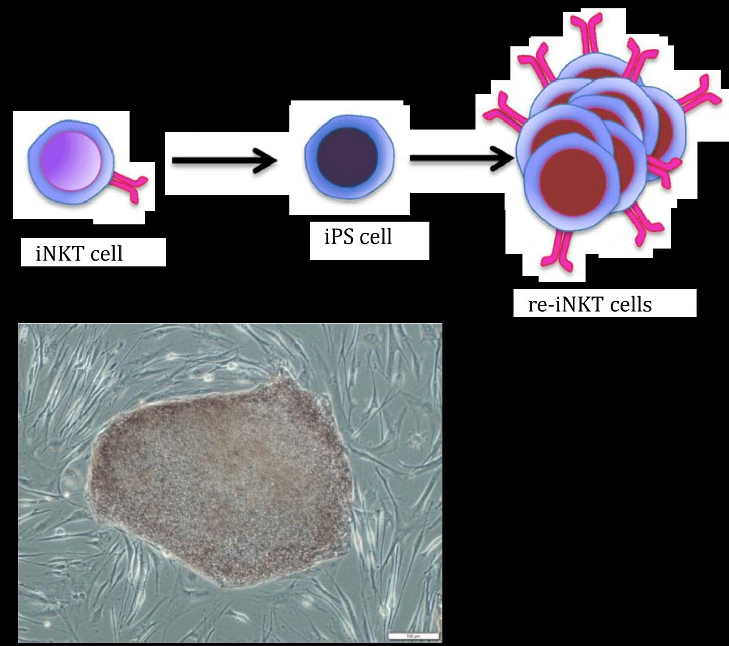 iNKT Cells Made by iPS Cell Technology