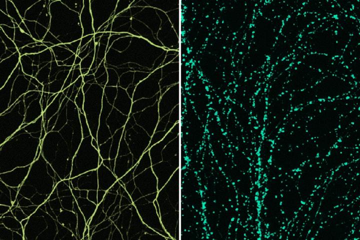Surprising Culprit in Nerve Cell Damage Identified