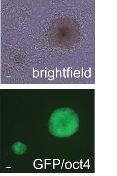 Colonies of Mouse iPS Cells