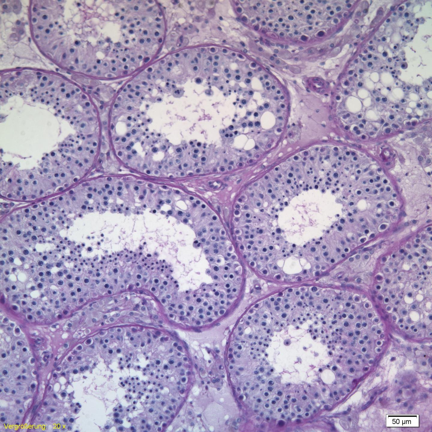 Section of a Normal Testes of a Young Man