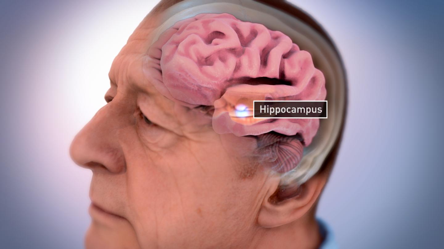 Alzheimer's Brain Illustration