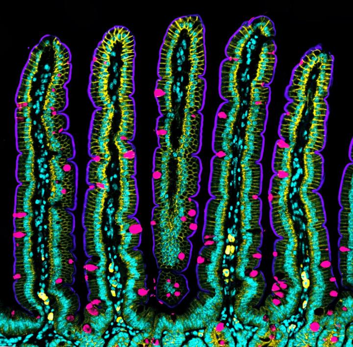 Researchers Discover How The Intestinal Epith Eurekalert