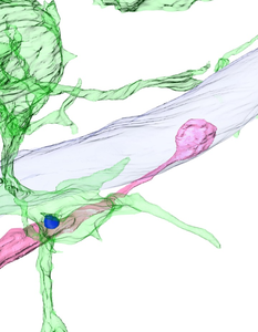 A synaptic spine engulfed by microglia in the adult brain