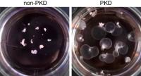 Kidney Organoids with and Without Cysts