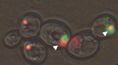 Sup35 Sequestration Polyglutamine Aggresome