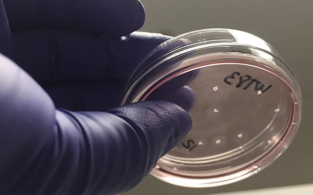 Brain Organoids in a Dish, UC San Diego Health Sciences