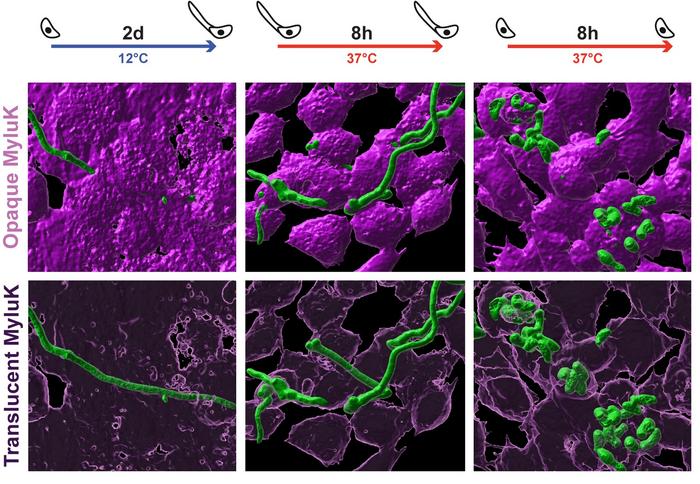 Pd hyphae and spore