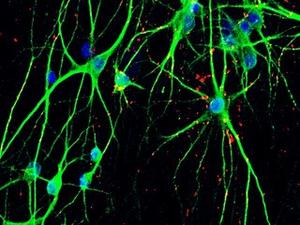 The fluorescence image of iPSC-converted neuron in a culture dish.