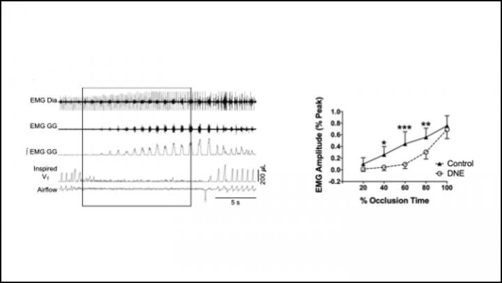 Fetal Nicotine Exposure Harms Breathing in Infants