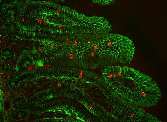 Percc1 Gene Expression in the Mouse Gut