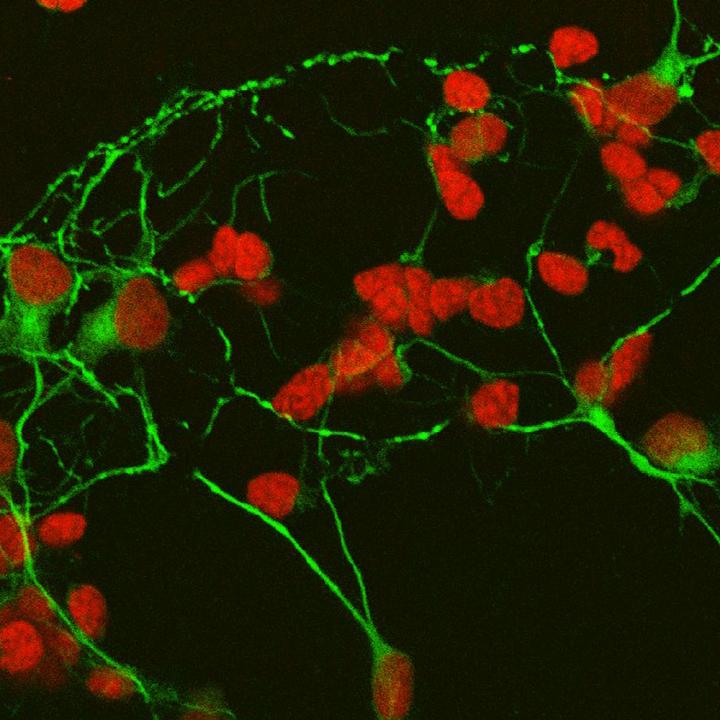 Photoreceptors and Amacrine cells