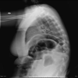 X-ray Imaging