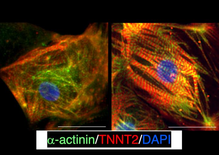 A Potential Method for Enhancing Heart Tissue Growth in Children