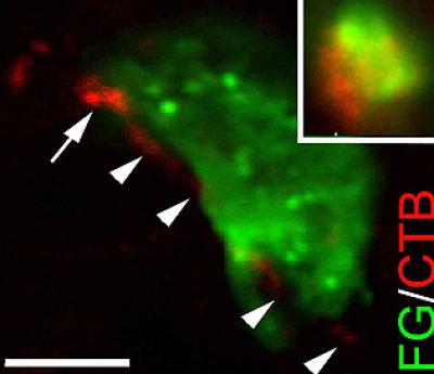 Target Cell with Regenerating Axons