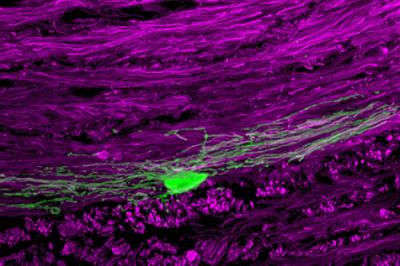 New Oligodendrocytes