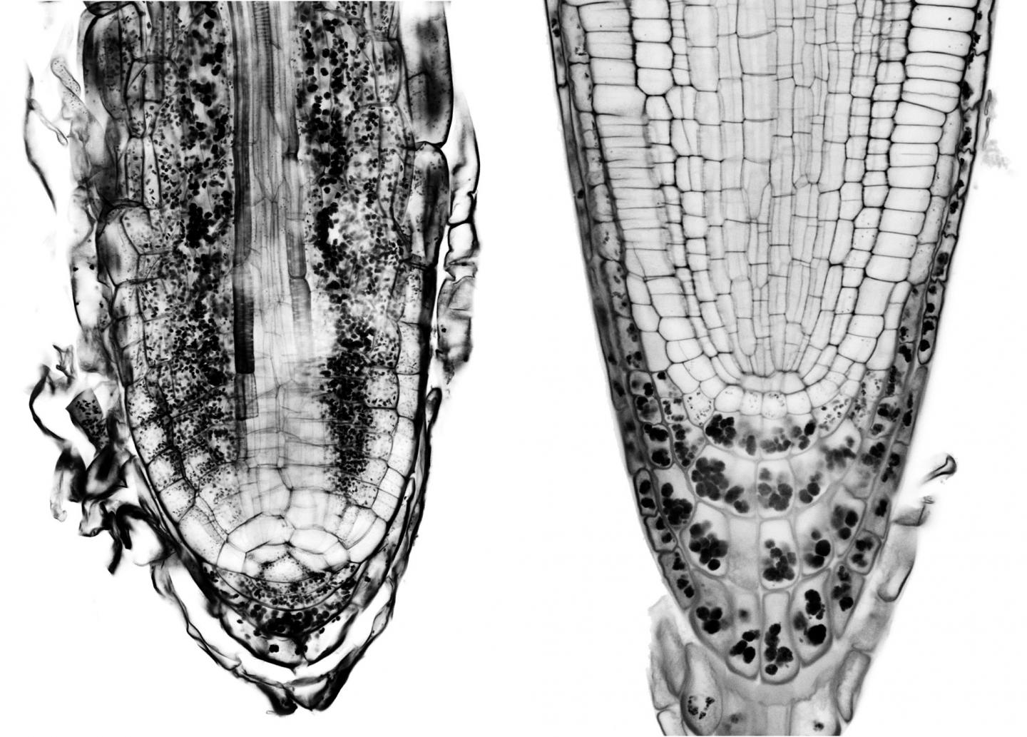 Amyloplasts