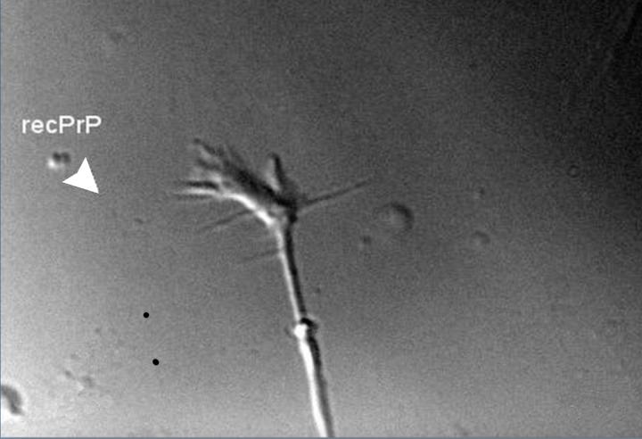 Hippocampal Growth Cone