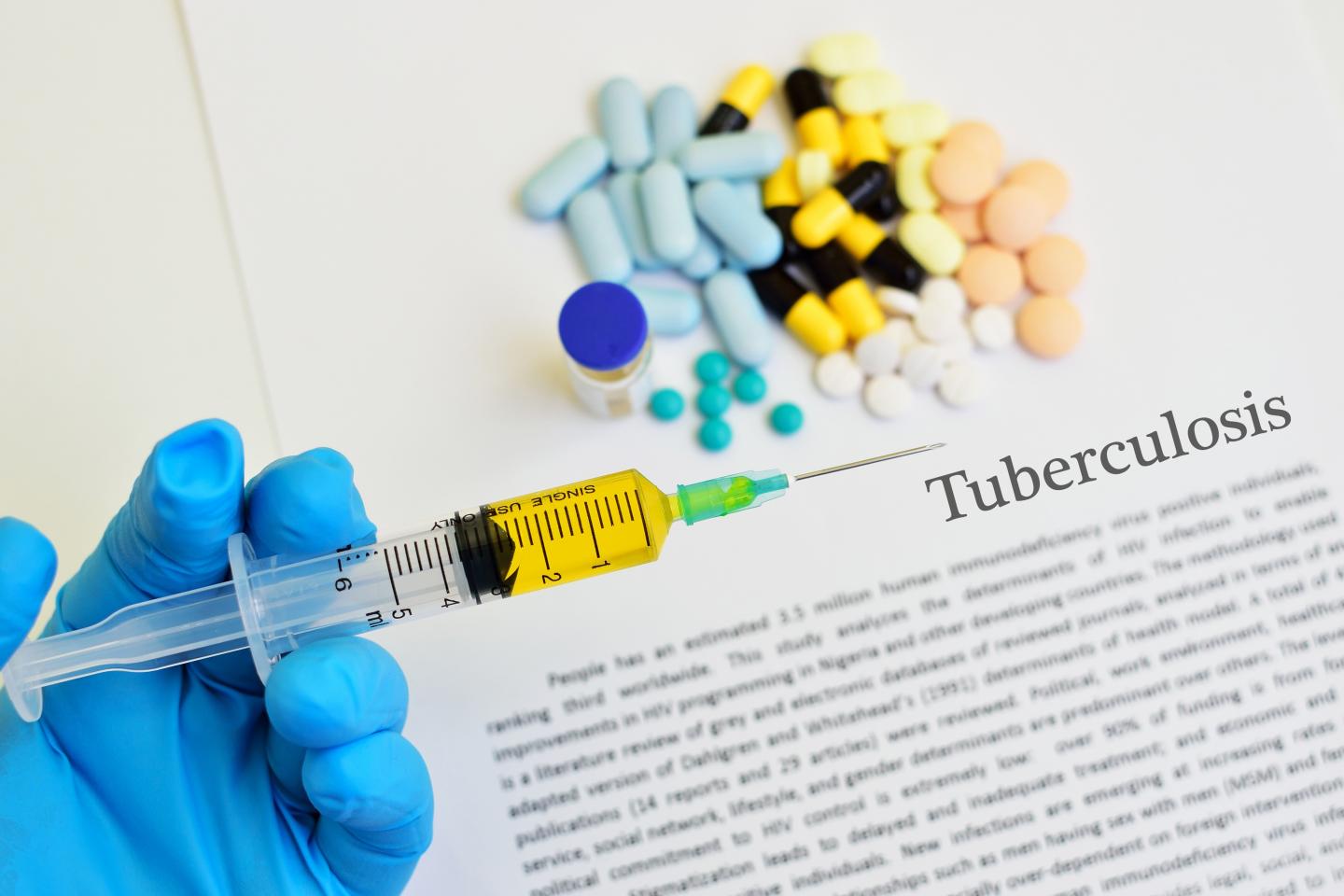 Tuberculosis Treatment