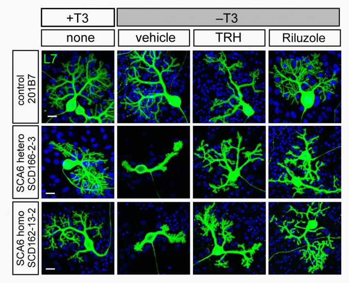 Damage to SCA6 Purkinje Cells Is Suppressed