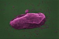 Bacteria 'popped' by antibiotic  - image two