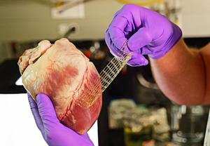 A Band-aid for the heart? New 3D-printed material could make it possible