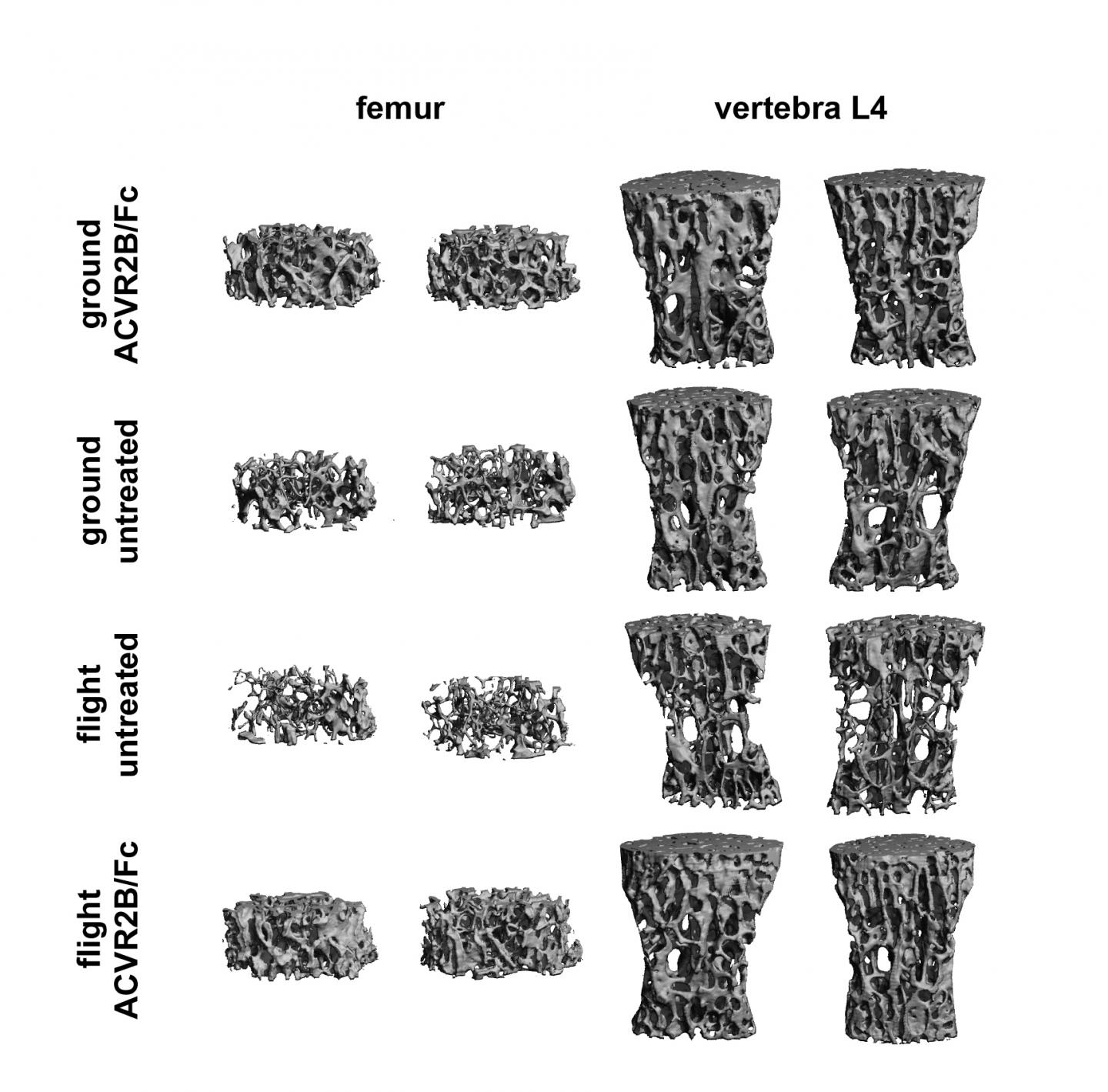 Mitigation of Bone Loss in Microgravity by Targeting Myostatin/activin a Signaling