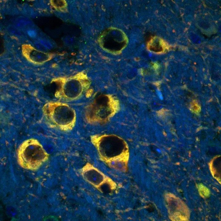 Iron-Dependent Staining Of Dopaminergic Neurons