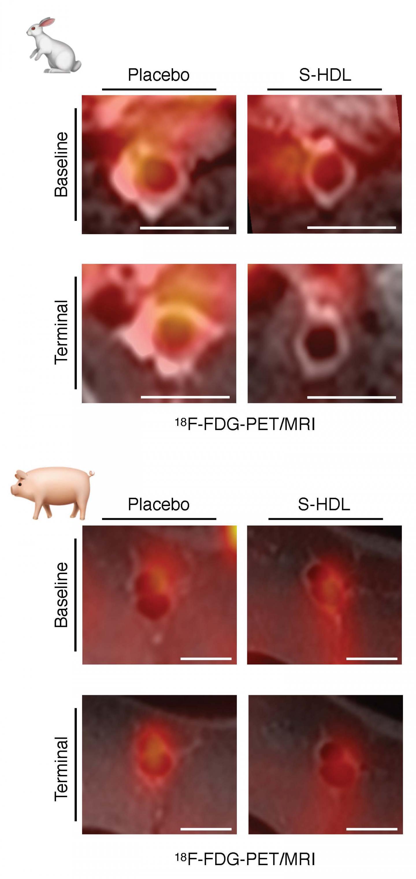 Scaling up a Nanoimmunotherapy for Atherosclerosis Through Preclinical Testing (1 of 8)