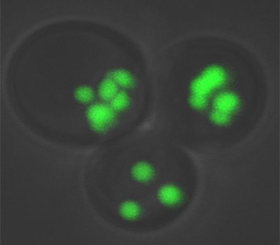 Normal Fat Accumulation in Yeast