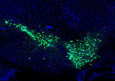 Dopamine Neurons Labeled with Green Fluorescent Protein