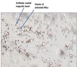 Marrow-Infiltrating Lymphocytes