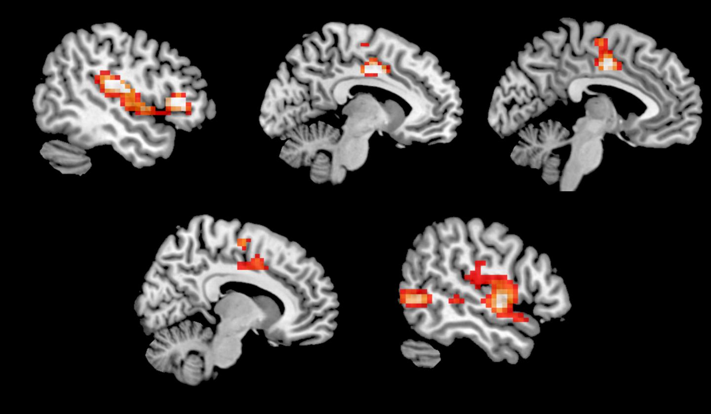 MDMA Brain Activity