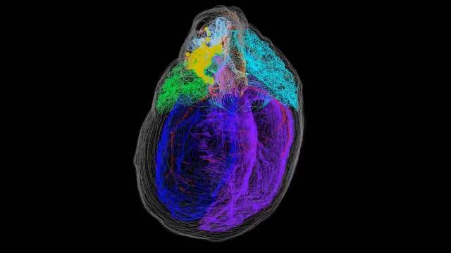A High-Resolution 3D Map of a Rat Heart Locating All the Neurons within the Intrinsic Cardiac Nervou