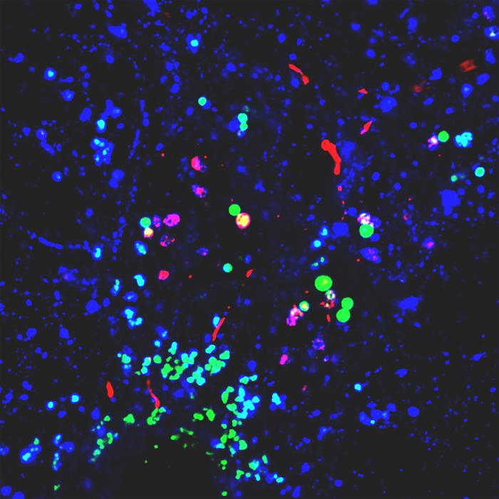 Nanoplastics in a Neuron