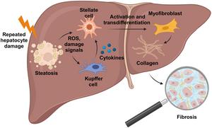 Schematic overview of the development of liver fibrosis in MASLD