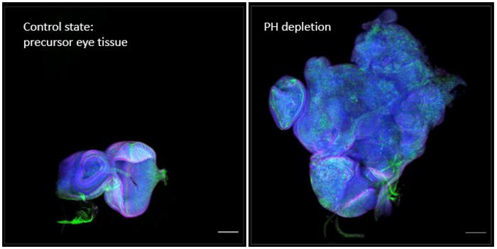 Example of a tumour obtained by reducing the expression levels of a Polycomb protein