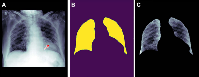 Special Report Lays Out Best Practices for Handling Bias in Radiology AI