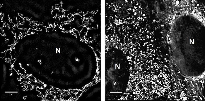 Deguelin Causes Mitochondrial Networks to Fragment