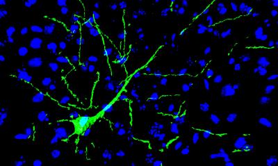 Transplanted Neurons