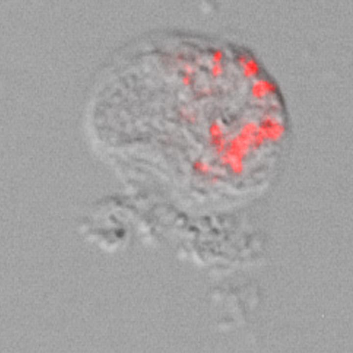 Light microscope image of a Thecofilosea amoeba