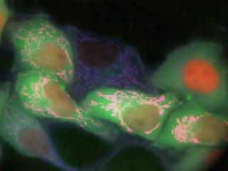 Colorful New Era of Calcium Imaging (3 of 3)