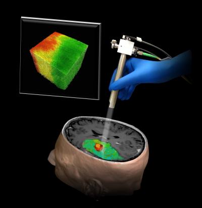 Optical Coherence Tomography in Brain Surgery