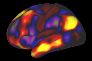 Default mode network