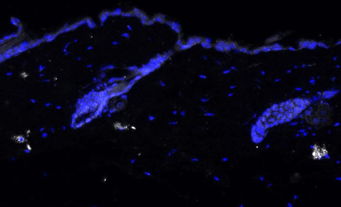 Tinción de inmunofluorescencia de IL-17 ( en blanco) en piel de ratón envejecido